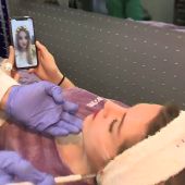 Los 'selfies' con filtros condicionan cada vez más las operaciones estéticas en la cara 