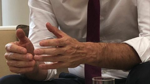 Manos de Pedro S&aacute;nchez