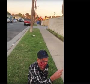 El anciano tras la agresión El anciano tras la agresión