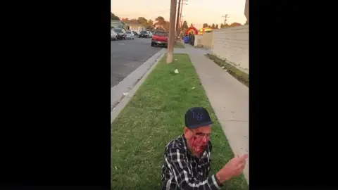 El anciano tras la agresión El anciano tras la agresión