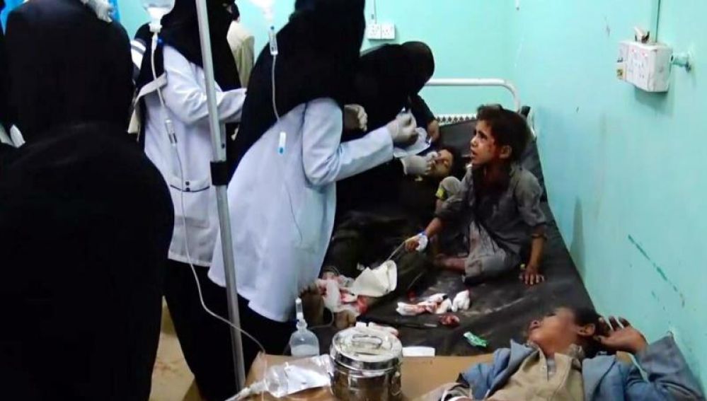 Varios niños heridos reciben atención médica en un hospital tras el bombardeo en Yemen