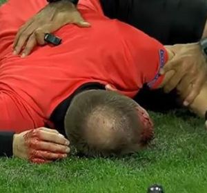 Terrible agresión en la Europa League Terrible agresión en la Europa League