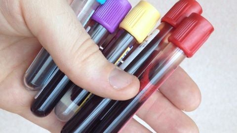 Transfusi&oacute;n de sangre