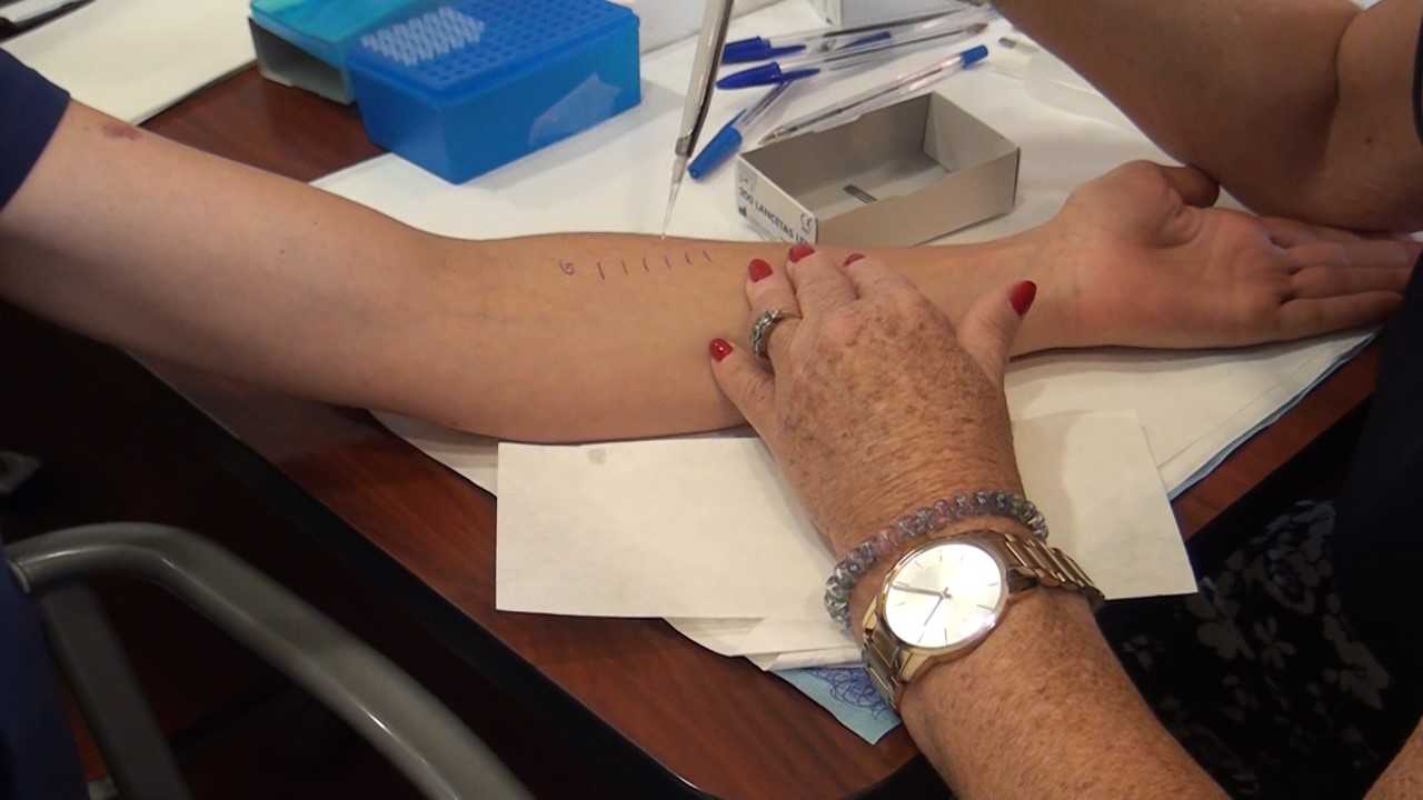 La UMH de Elche participa en un estudio sobre enfermedades alérgicas La UMH de Elche participa en un estudio sobre enfermedades alérgicas