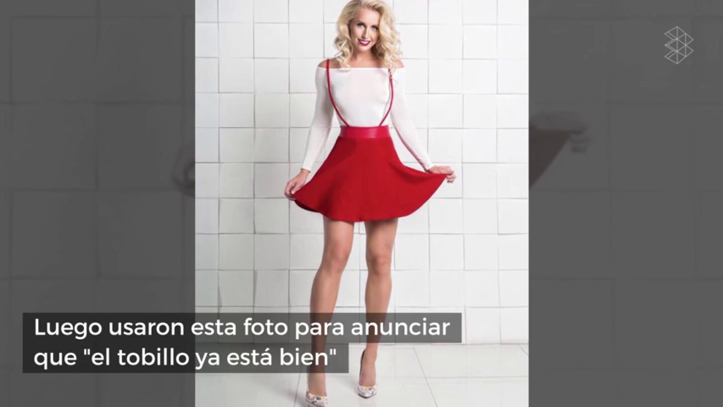 Polémica foto machista del Spartak de Moscú para comunicar que su jugadora está lesionada