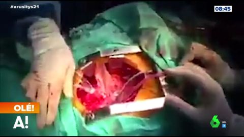 Las espectaculares im&aacute;genes de una operaci&oacute;n a coraz&oacute;n abierto durante un terremoto 