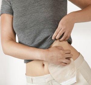 Ostomías Ostomías