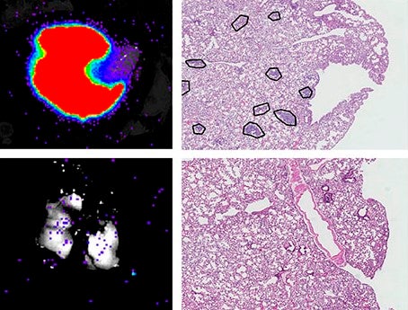 Crean un nuevo fármaco oncológico que evita la metástasis y reduce el tumor Crean un nuevo fármaco oncológico que evita la metástasis y reduce el tumor