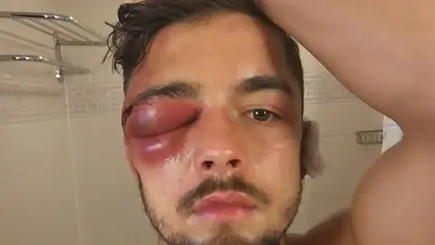 La lesión que obliga a retirarse del mundial superligero a Anthony Yigit La lesión que obliga a retirarse del mundial superligero a Anthony Yigit