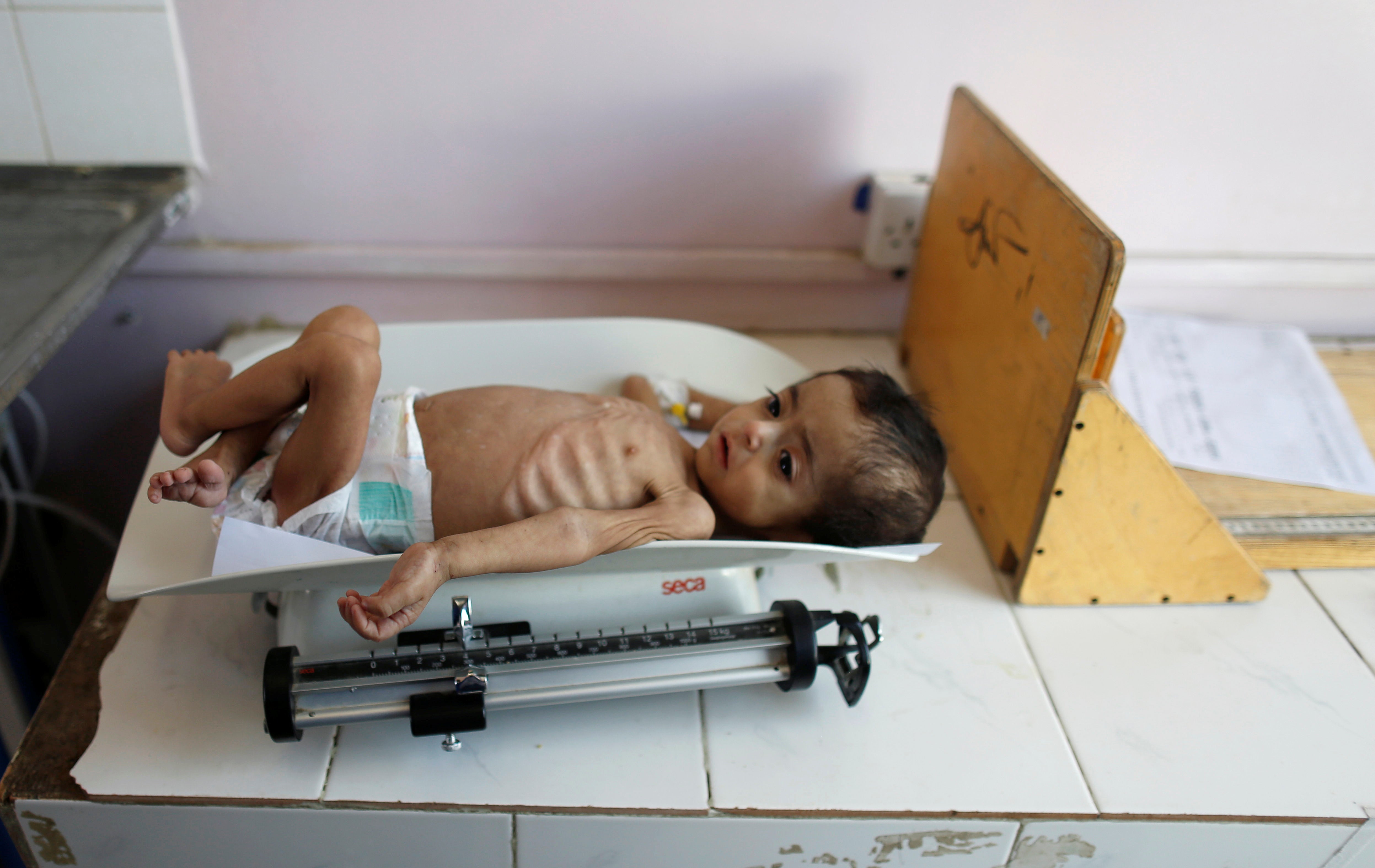 Unos 85.000 niños han muerto de hambre en Yemen en los últimos cuatro años Unos 85.000 niños han muerto de hambre en Yemen en los últimos cuatro años