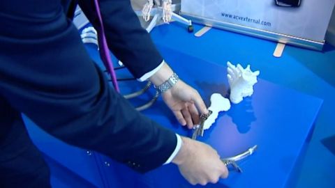 Noticias fin de semana (25-11-18) Fallos en el sistema de implantes m&eacute;dicos provocan miles de v&iacute;ctimas en el mundo