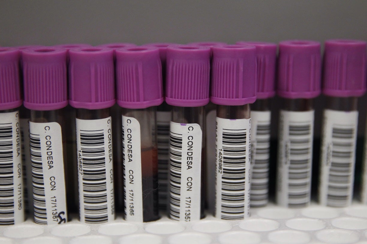 Investigadores españoles descubren una forma de eliminar las células que reactivan el VIH Investigadores españoles descubren una forma de eliminar las células que reactivan el VIH