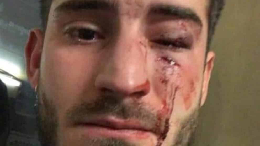 Detenidas dos personas por una brutal agresión homófoba a un joven en el Metro de Barcelona Detenidas dos personas por una brutal agresión homófoba a un joven en el Metro de Barcelona