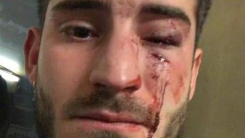 Imagen de la v&iacute;ctima de la agresi&oacute;n en el metro de Barcelona.