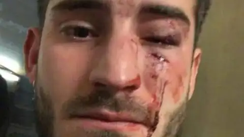 Imagen de la víctima de la agresión en el metro de Barcelona. Imagen de la víctima de la agresión en el metro de Barcelona.