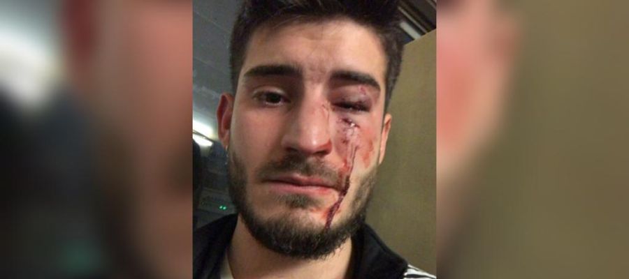 El joven que ha sido víctima de una agresión El joven que ha sido víctima de una agresión