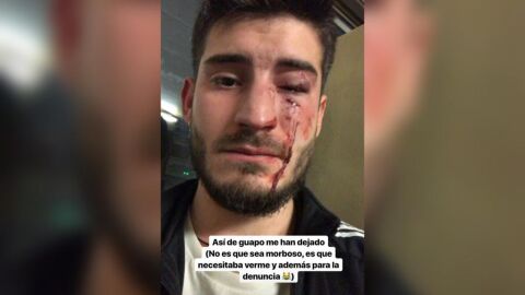 El joven que ha sido v&iacute;ctima de una agresi&oacute;n
