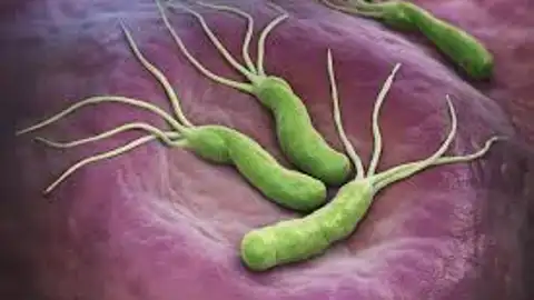 Helicobacter Pylori La farmacia en casa