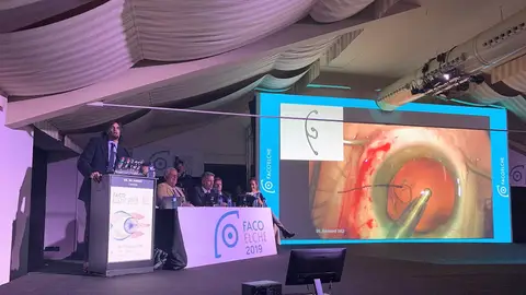 El doctor Ike Ahmed durante su conferencia sobre maniobras extremas intraoculares! El doctor Ike Ahmed durante su conferencia sobre maniobras extremas intraoculares!