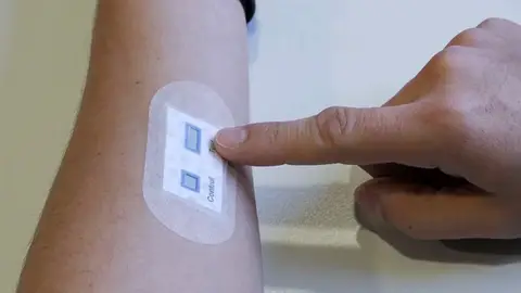 Un nuevo parche para la piel facilita el diagnostico de la fibrosis quistica Un nuevo parche para la piel facilita el diagnostico de la fibrosis quistica