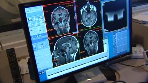 El cerebro humano genera nuevas neuronas hasta los 90 a&ntilde;os