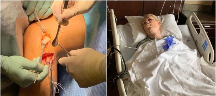 Imágenes de la operación de Lindsey Vonn Imágenes de la operación de Lindsey Vonn