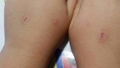 Las manos de un ni&ntilde;o que ha jugado al 'abecedario del diablo'