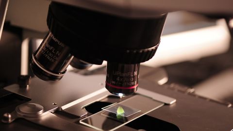 Una muestra analizada mediante microscopio