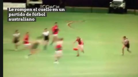 Duras im&aacute;genes: le rompen el cuello en un partido de f&uacute;tbol australiano