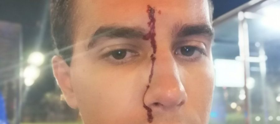 El periodista Xavier Martínez tras sufrir una agresión homófoba El periodista Xavier Martínez tras sufrir una agresión homófoba