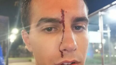 El periodista Xavier Mart&iacute;nez tras sufrir una agresi&oacute;n hom&oacute;foba