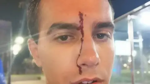 El periodista Xavier Martínez tras sufrir una agresión homófoba El periodista Xavier Martínez tras sufrir una agresión homófoba