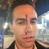 El periodista Xavier Martínez tras sufrir una agresión homófoba