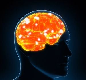 Cerebro Cerebro