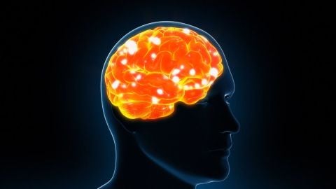 Cerebro