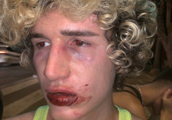 Brutal agresión homófoba a un joven en una discoteca de Valencia Brutal agresión homófoba a un joven en una discoteca de Valencia