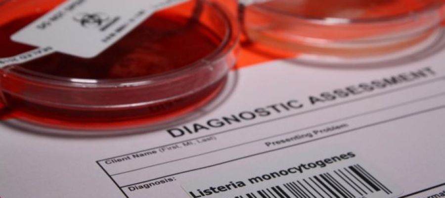 ¿Qué es y cuáles son los síntomas de la listeriosis? ¿Qué es y cuáles son los síntomas de la listeriosis?