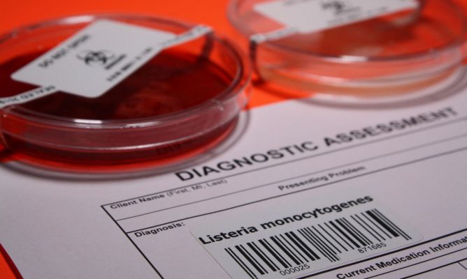 Salut confirma un caso de listeria en Palma Salut confirma un caso de listeria en Palma