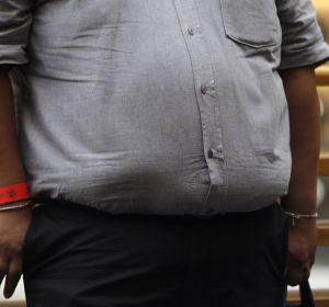 Un hombre con obesidad Un hombre con obesidad