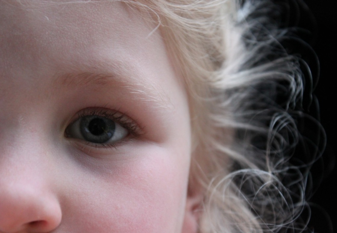 Diez consejos para eliminar los piojos Diez consejos para eliminar los piojos