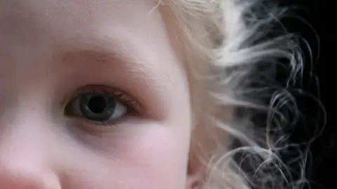 Diez consejos para eliminar los piojos EN BUENAS MANOS