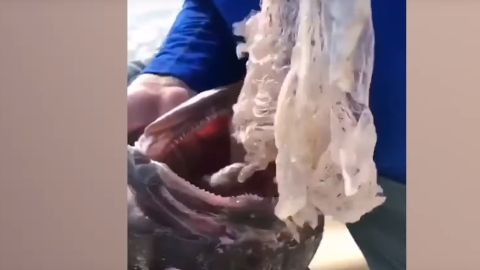 Extraen bolsas de pl&aacute;sticos del interior de un pez