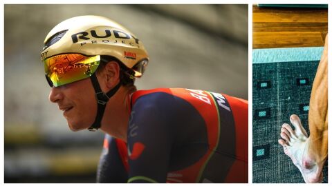 El ciclista esloveno Janez Brajkovic y el impactante estado de su pierna