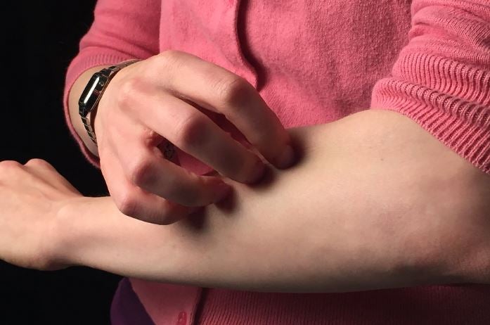 Lanzan ‘Psoriasis sin límites’, proyecto para explicar la enfermedad psoriásica y promover su detección precoz Lanzan ‘Psoriasis sin límites’, proyecto para explicar la enfermedad psoriásica y promover su detección precoz
