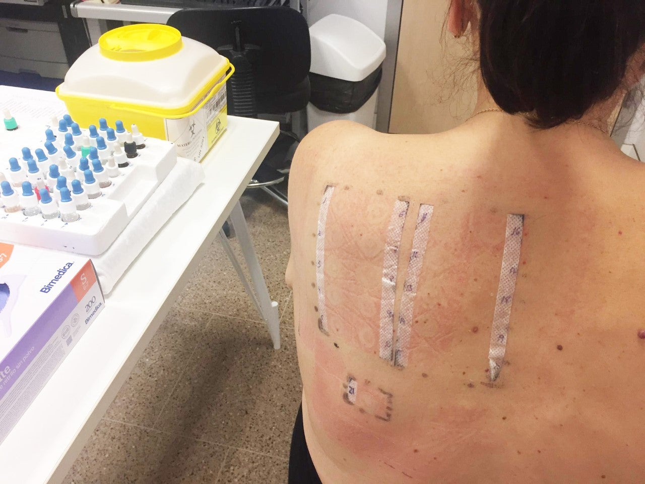 Una investigación del Hospital del Vinalopó demuestra la baja incidencia alérgica de los conservantes utilizados en cosméticos Una investigación del Hospital del Vinalopó demuestra la baja incidencia alérgica de los conservantes utilizados en cosméticos