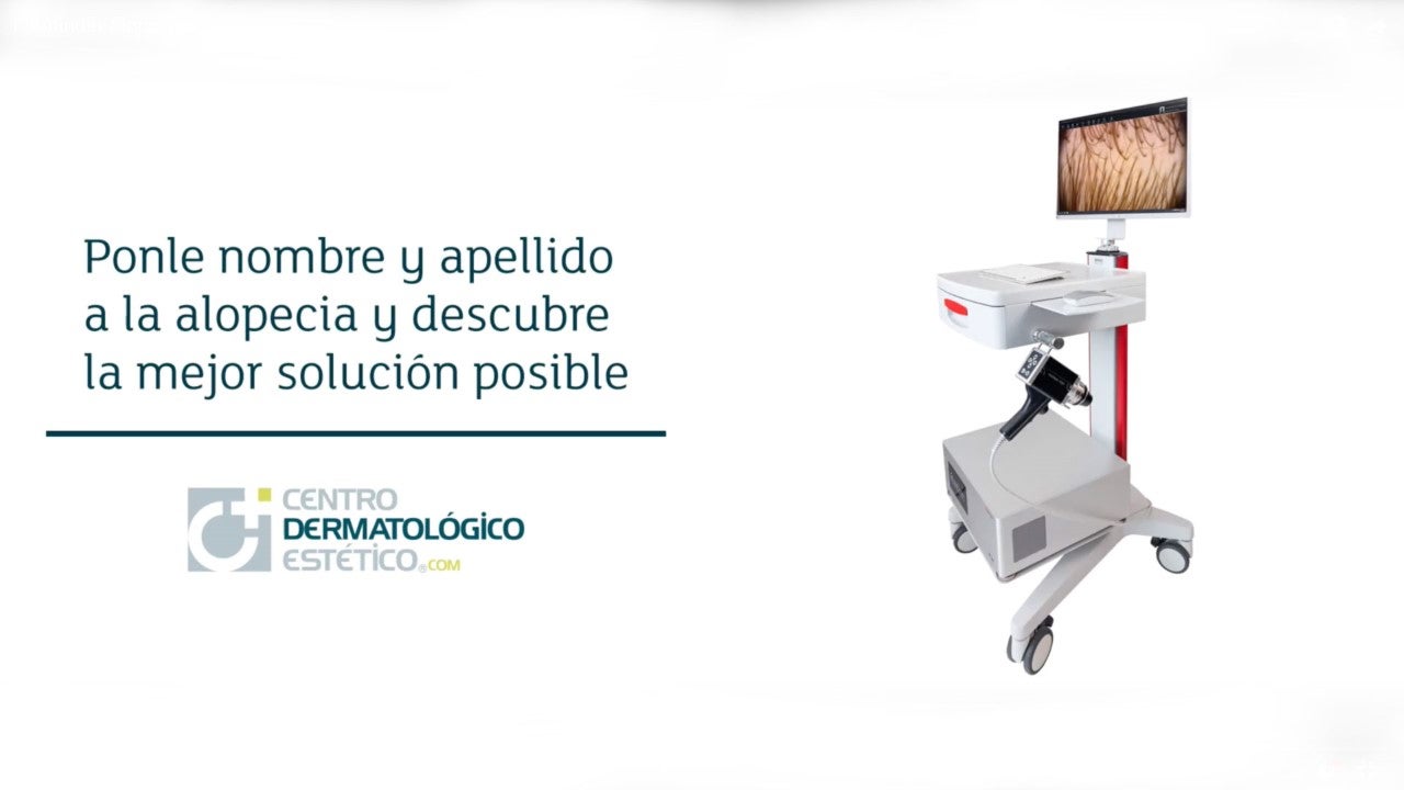 La alopecia tiene tratamiento, pero para dar con el más adecuado ha de haber un buen diagnóstico La alopecia tiene tratamiento, pero para dar con el más adecuado ha de haber un buen diagnóstico