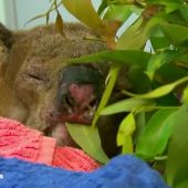El koala rescatado en medio de las llamas se recupera en un hospital de Australia