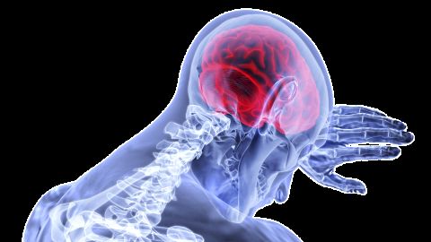 Cerebro