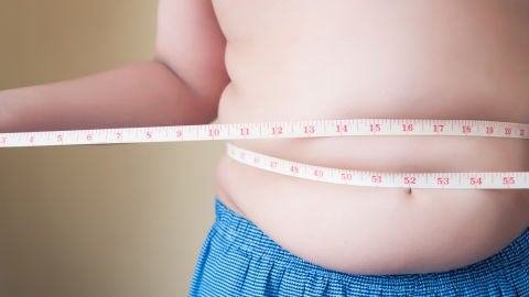 Obesidad infantil