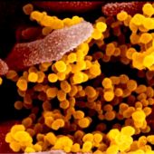Coronavirus a vista de microscopio